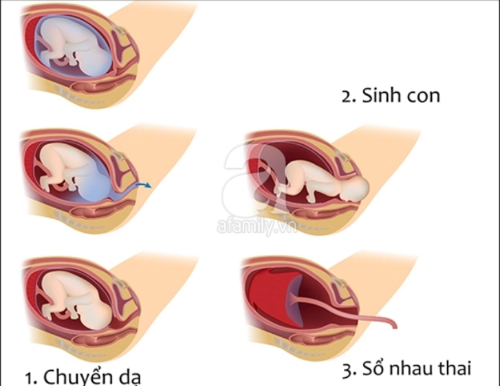 Sinh con tự nhiên