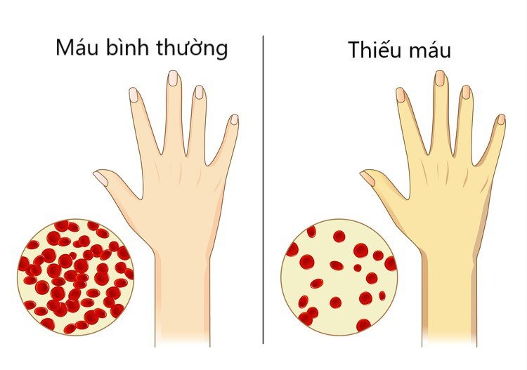 mẹ bầu thông thái